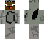 zyphalopagus