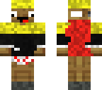 king zyphalopagus