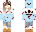 hurt baby