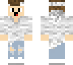 eyy my skin