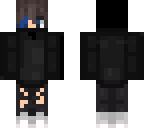 infected niteyt skin