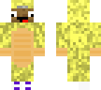 zyphalopagus