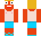 random sunburn guy