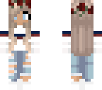 kia's other skin