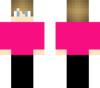 the ugly and fat skin by ytboiiiiiiii