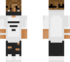 tyler's skin