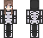 skele lizzie