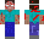 chicken pox apocalypse