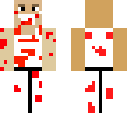 bloody surgeon