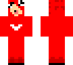 knuckles