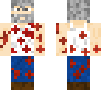 logan with bullet injuries