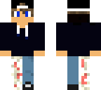 broken leg evil boy