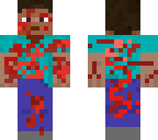 injured steve