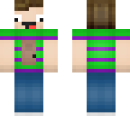 zyphalopagus remake