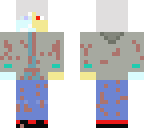 frozen-albino_killer