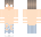fixed boy