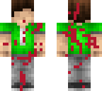 injuried subzeroextybyte