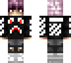 my skin