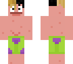 ***patrickstar