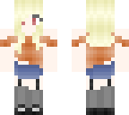 albino girl