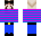 fixed