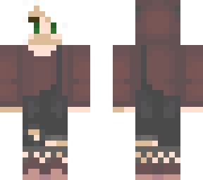 vitiligo