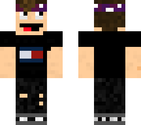 my own first skin