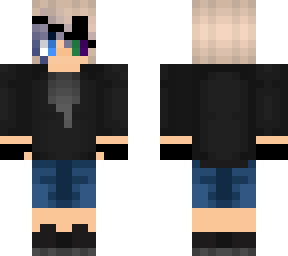 sarie with her eyepatch up