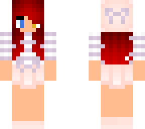 redhead heterochormia