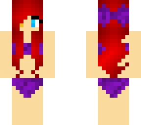 redhead heterochormia