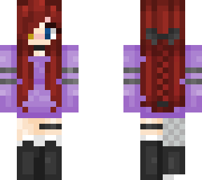 redhead heterochormia