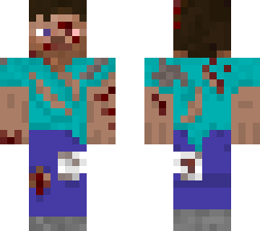 injured steve