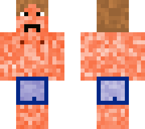 man with skin cancer who will get better soon, because he has lot of care, so ok