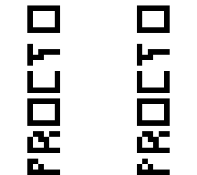 procto
