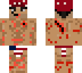 ricardo milos hurt