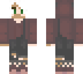 lil darker vitiligo