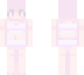 albinism - sb
