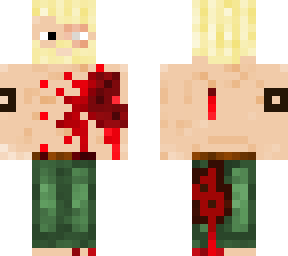 blonde dude that is shirtless and heavily wounded