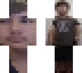 my skin