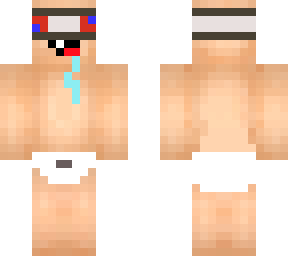 baby xray
