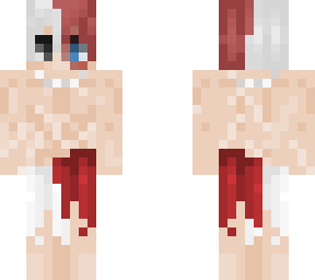 triton todoroki shoto scars
