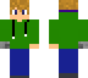 boy with prosthetic arm (2)