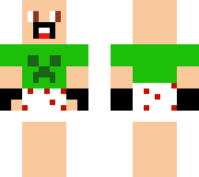 pepe el peladito culo con caspa