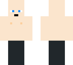 downsyndrom