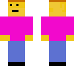 very ugly skin  2