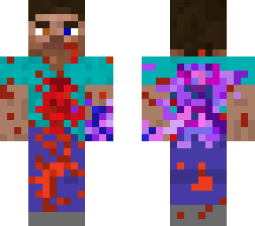 killer steve with infected hand and back