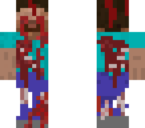 patient 305: steve