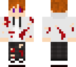 injured ginger