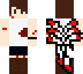 injured