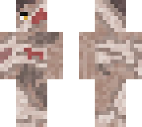 leper